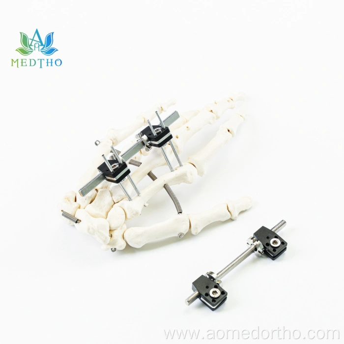 external fixator ankle